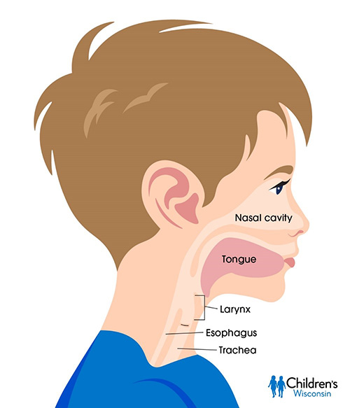 Aerodigestive conditions