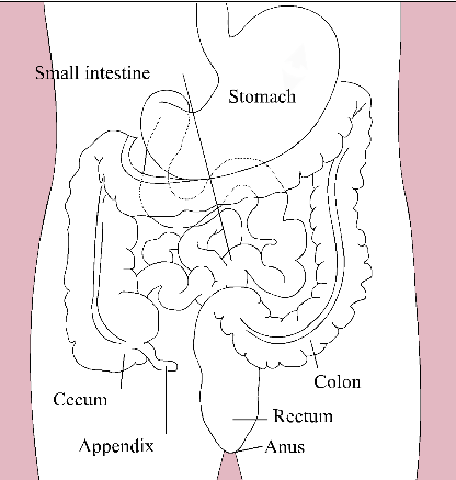 Jejunostomy tube aka J-tube