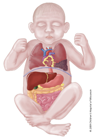 Microcystic lesions include more numerous and smaller cysts Microcystic lesions occur in about 40 percent of CPAM cases.