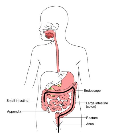Colonoscopy diagram