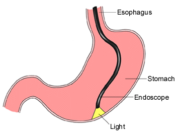 Esophagus diagram