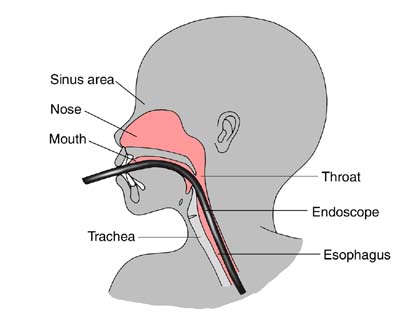 Sinus area diagram