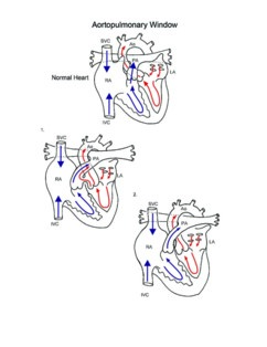 Aortopulmonary Window illustration