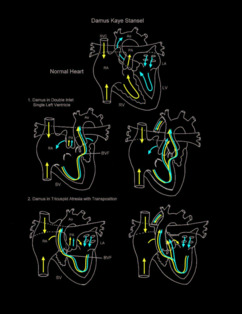 Damus Kaye Stansel illustration