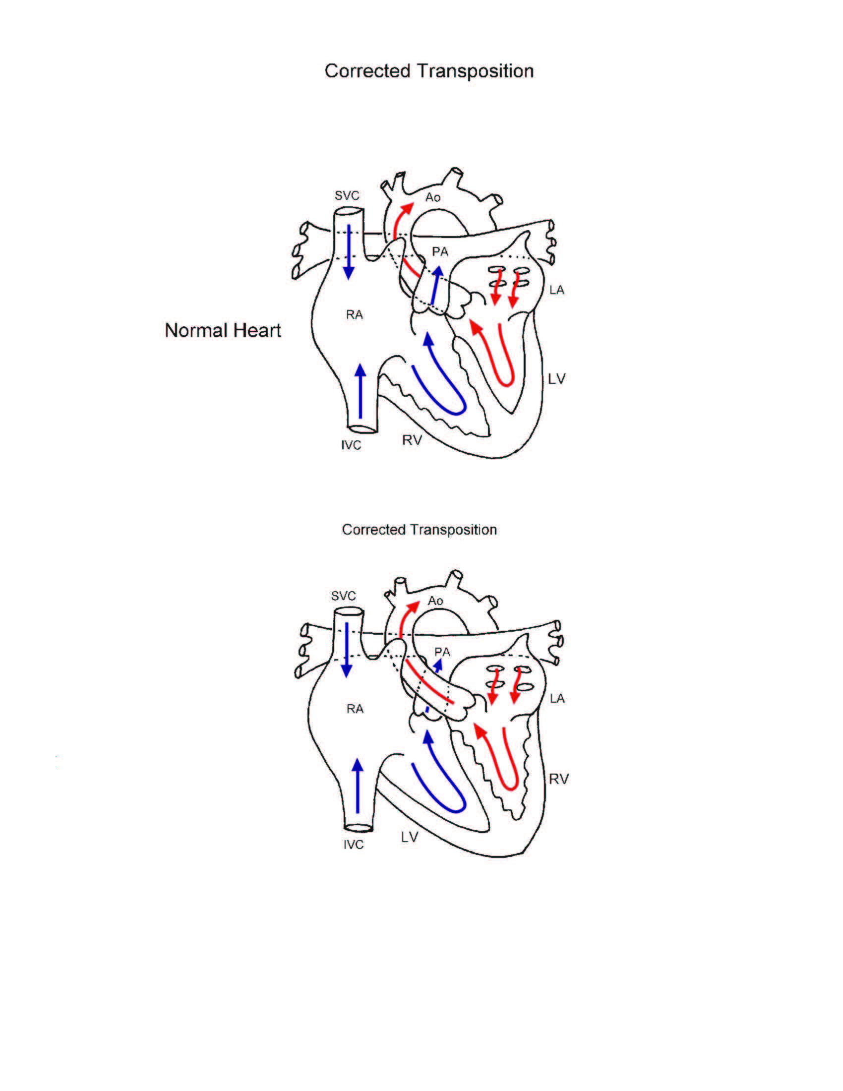 Double Switch Procedure illustration 1