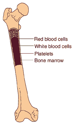 Diagram of bone blood for marrow treatment for Immunodeficiency