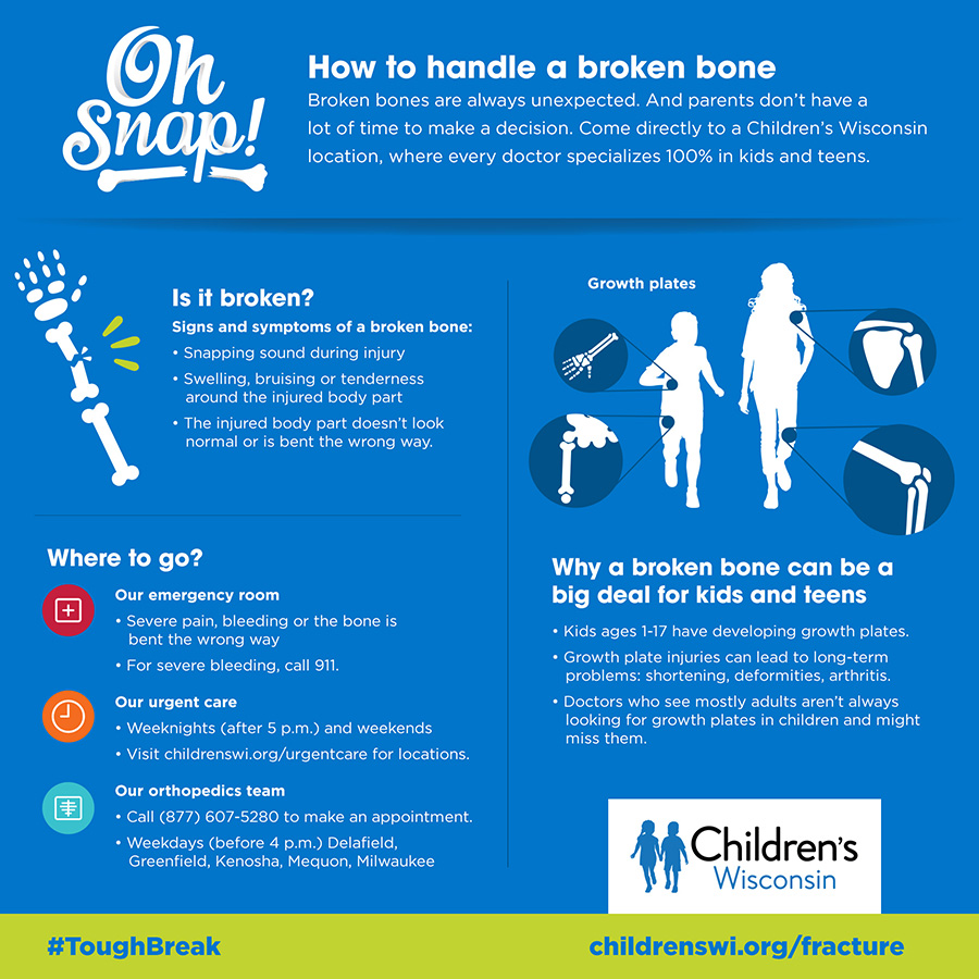 How to handle a broken bone infographic