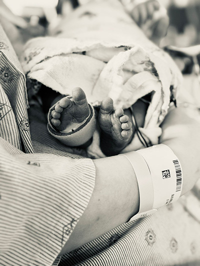 Sloane bilateral vocal cord paralysis Children's Wisconsin NICU