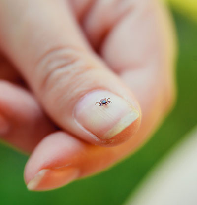 A Parent's Guide to Ticks Children's Wisconsin