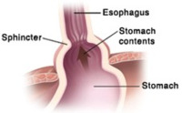 Stomach Diagram