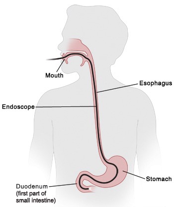 gi anatomy