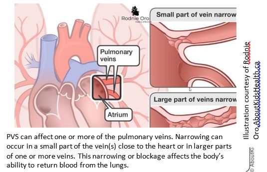 heart vein