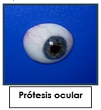 ocular