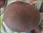 child with rounded head in back