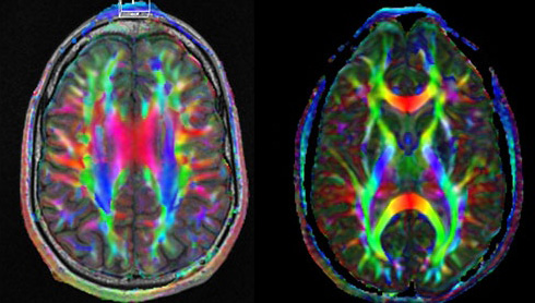 Neuro research