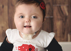 Children's Tracheostomy patient, Mallory Brozs 1st Birthday