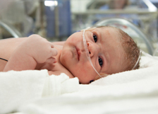 Photo of baby at the Children's Wisconsin-Fox Valley Hospital NICU