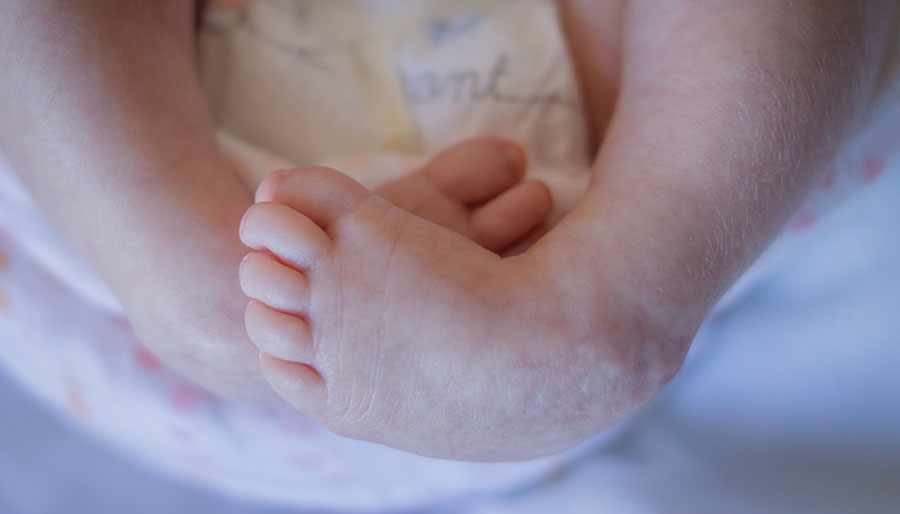 Marlowe S Clubfoot Journey How One Mom Went From Devastated To Reassured Children S Wisconsin