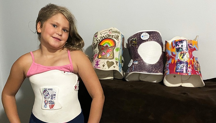 Care with comfort: New 3D-printed braces give relief for kids with scoliosis
