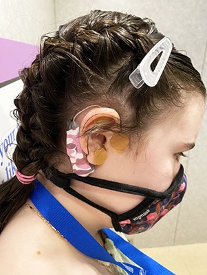 Charlotte cyclic vomiting syndrome auricular neurostimulation Children's Wisconsin Gastroenterology, Liver and Nutrition Program 