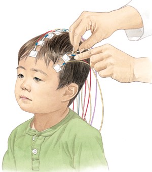Child with EEG