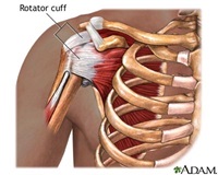 3047 Rotator Cuff